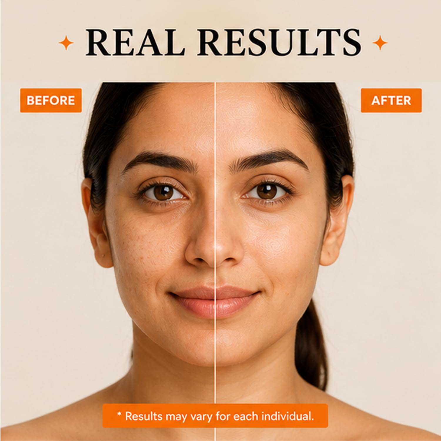 moisturizer (1, Retinol0.2% Cream)