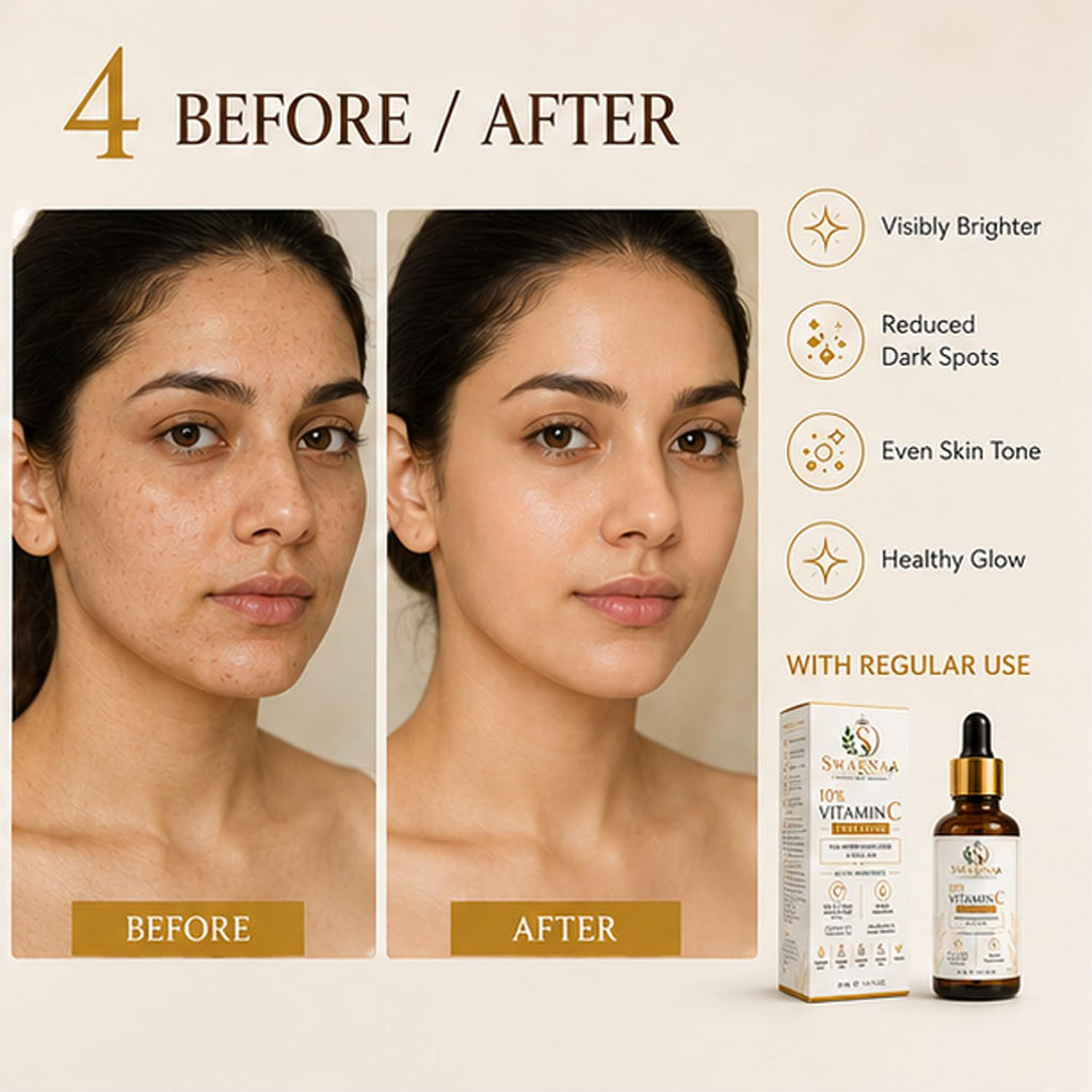 Swarnaa 10% Vitamin C Face Serum for Dull & Uneven Looking Skin | Helps Improve Skin Radiance, Supports Brighter-Looking Skin & Even Skin Tone | Lightweight Daily Facial Serum for Men & Women | 30ml