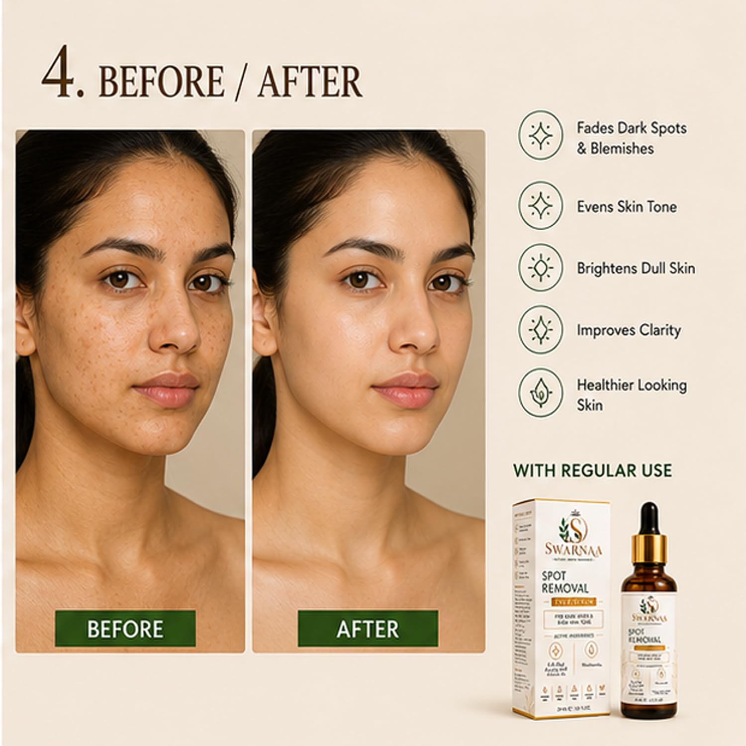 Swarnaa Spot Removal Face Serum for Dark Spots & Uneven Skin Tone | Helps Improve Skin Radiance, Supports Brighter-Looking Skin & Skin Clarity | Lightweight Daily Facial Serum for Men & Women | 30ml