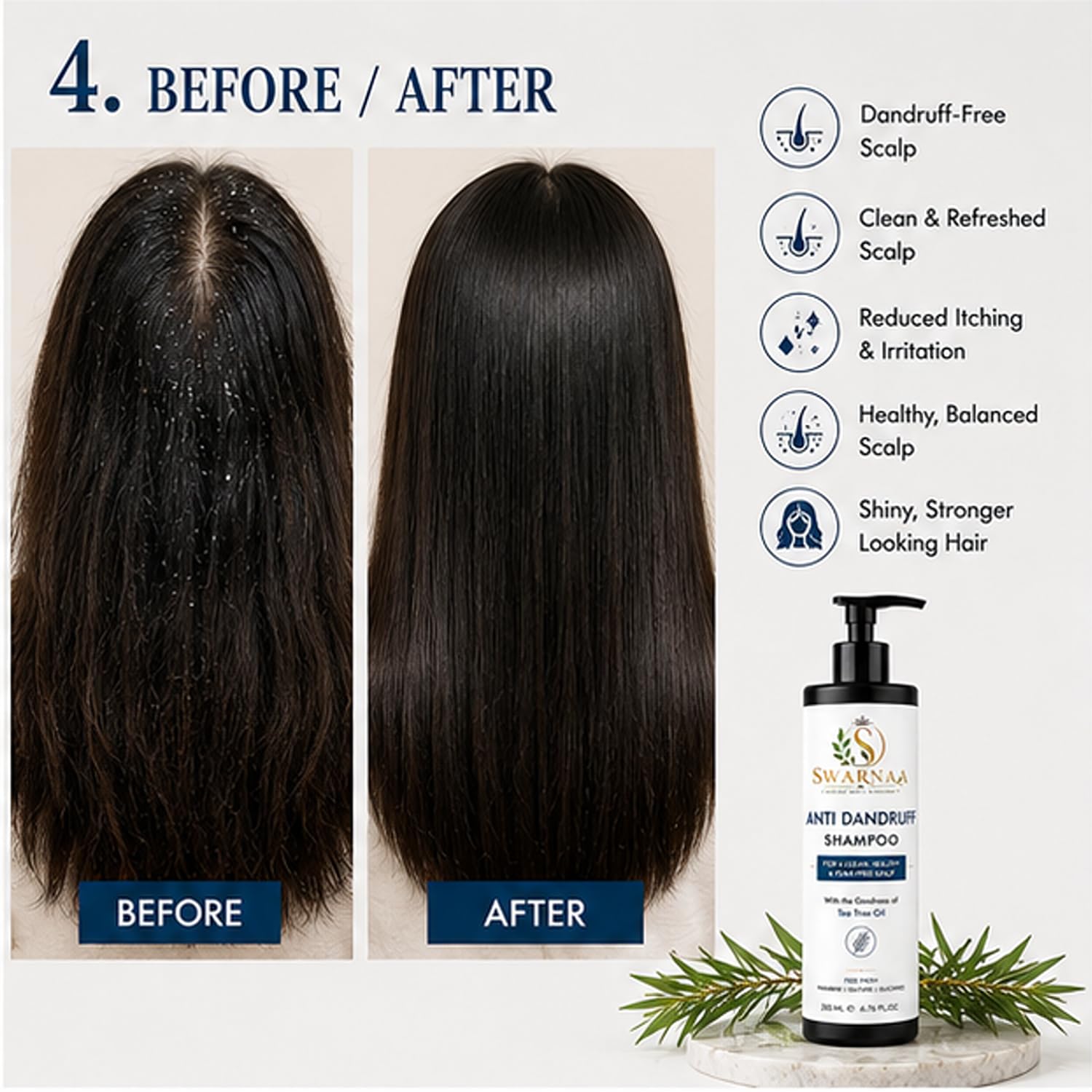 Swarnaa Anti Dandruff Shampoo for Scalp Care & Hair Cleansing | Helps Remove Scalp Build-Up, Refresh Scalp & Reduce Visible Flakes | Gentle Daily Use Shampoo for Men & Women | All Hair Types | 200ml