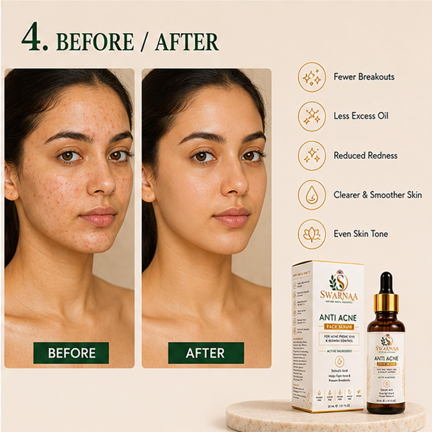 Swarnaa Anti Acne Face Serum with Salicylic Acid for Acne Prone Skin | Helps Reduce Excess Oil & Supports Clearer Looking Skin | Lightweight Daily Face Serum for Men & Women | 30ml